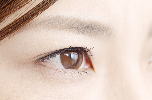 眼内レンズについて